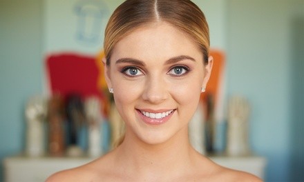 One Syringe of Volbella or Vollure with Optional 20 Units of Botox at Infinity Med-I-Spa (Up to 34% Off)