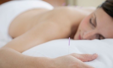 One or Three 60-Minute Acupuncture Sessions at The Gathering Point Community Acupuncture (Up to 69% Off)