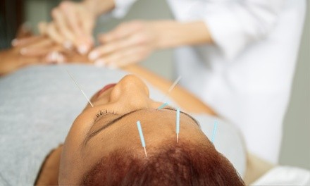 Wellness Package with One or Three Acupuncture Treatments and Metabolic Assessment at Wellness and Acupuncture (74% Off)